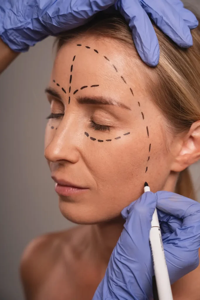 Face Lift