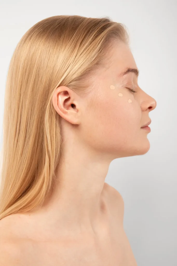 Otoplasty