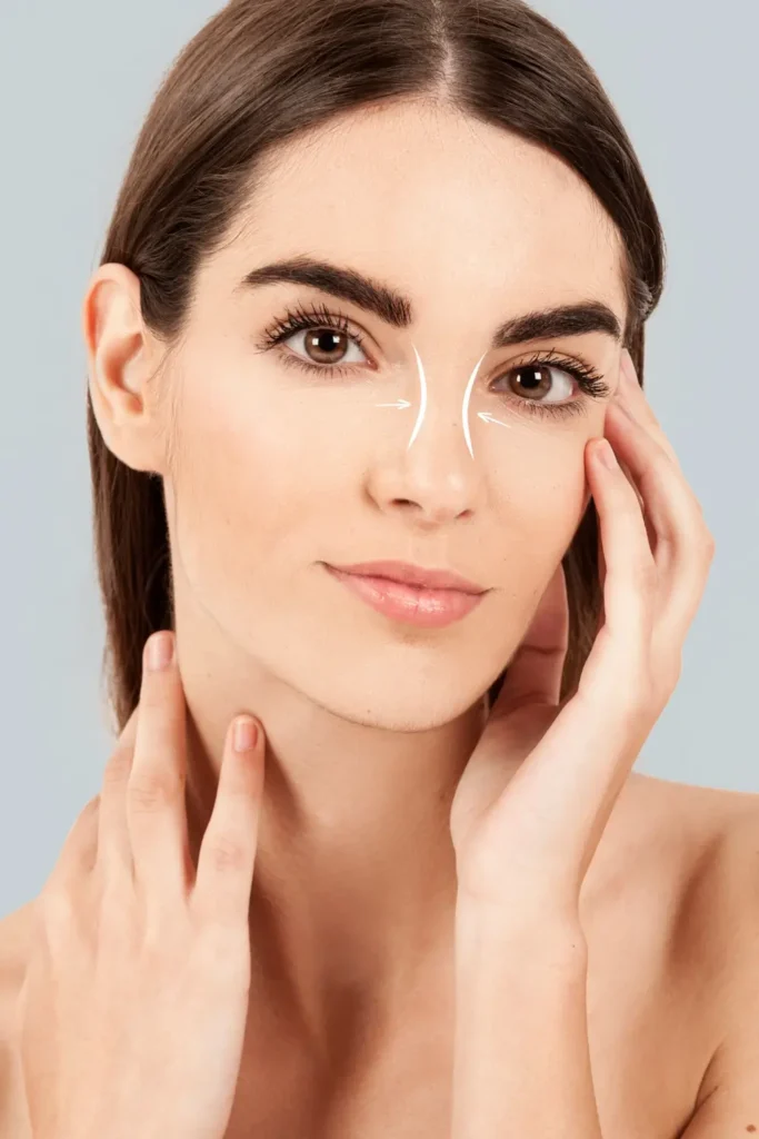 Rhinoplasty