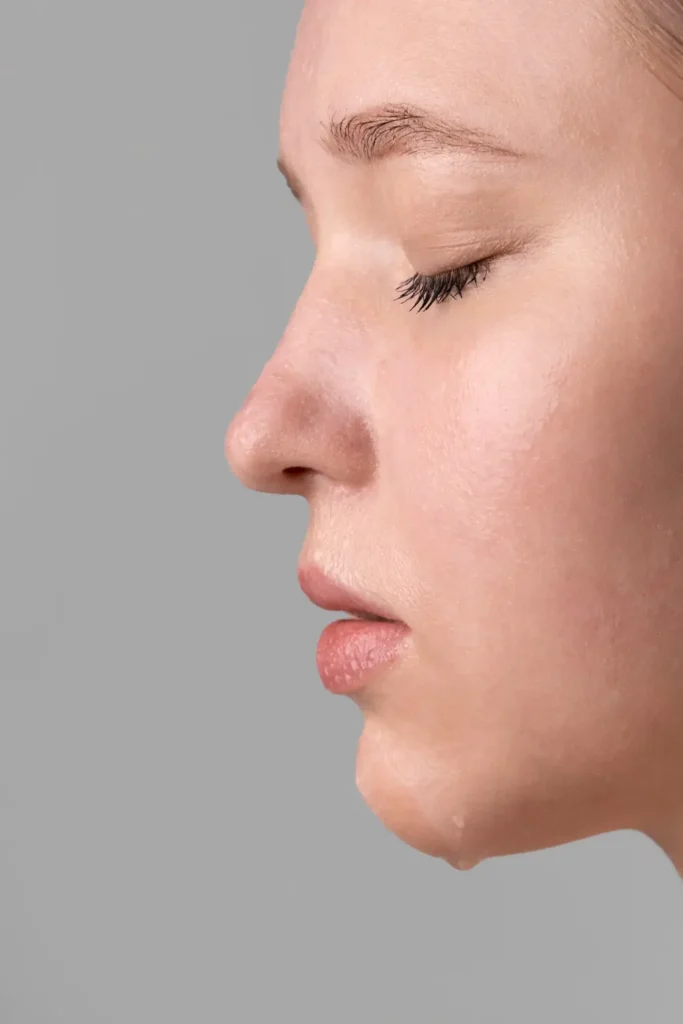 Septorhinoplasty